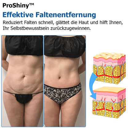 🟩Proshiny™ Thermische Zyklusformende Leggings - Hergestellt in Deutschland