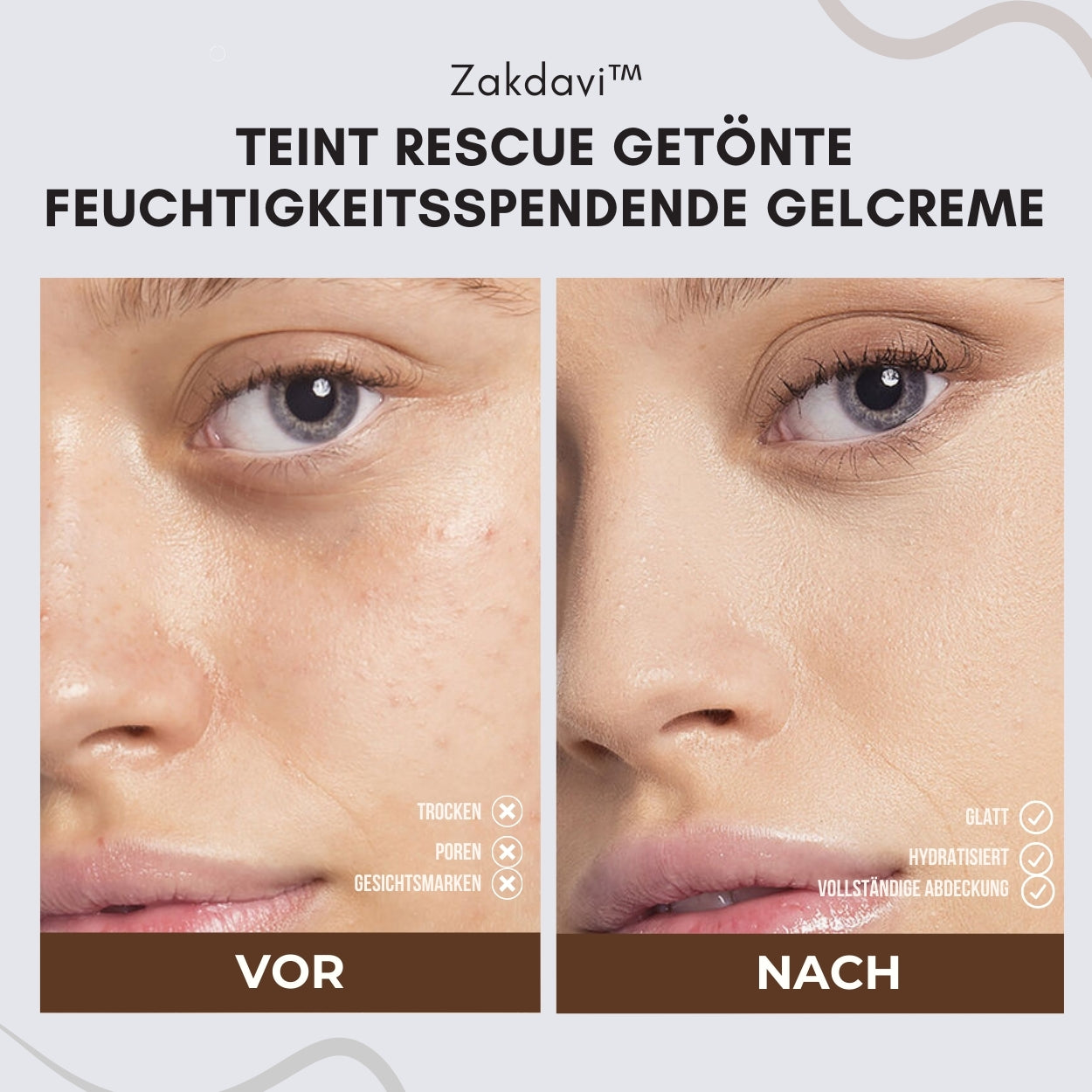 🪐Zakdavi™ Teint-Rescue Getönte Feuchtigkeitsspendende Gel-Creme