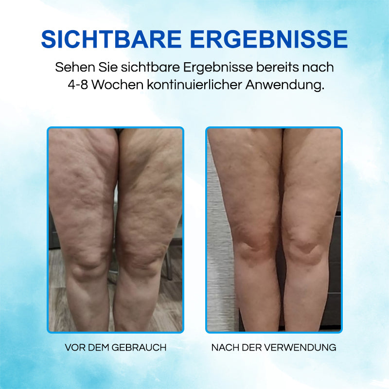 ✨ProShiny™ CelluBliss Hosen - Hergestellt in Deutschland