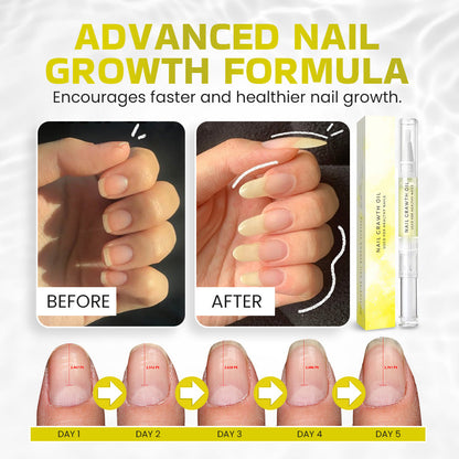 NEGUSY Rejuvenation Nail Growth Oil